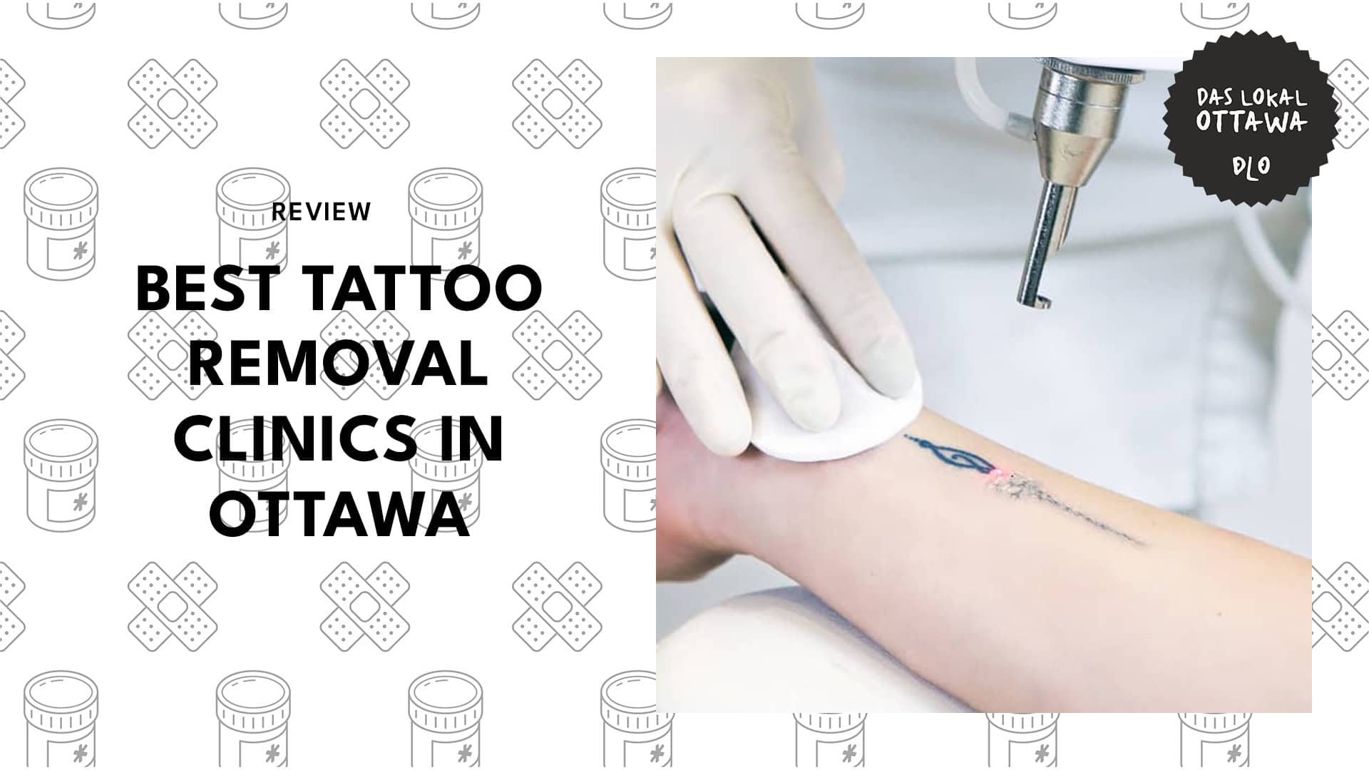 tattoo-removal-spots-in-ottawa